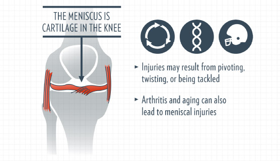 Relieving Knee Pain With Orthopedic Surgery