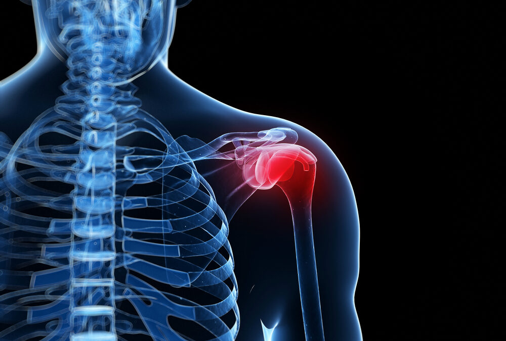 What You Need to Know About Rotator Cuff Injuries