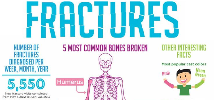 5 Most Common Bone Fractures for Kids